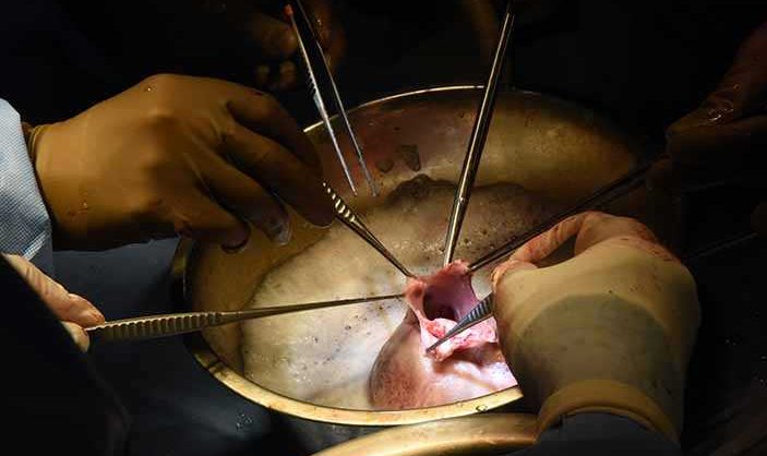 Xenotransplantasi Sebuah Proses transplantasi Organ Jaringan