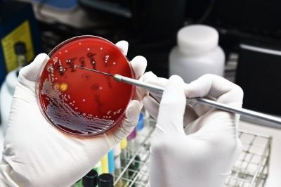 Ancaman Superbug Meningkat: WHO Sebut Infeksi Bakteri