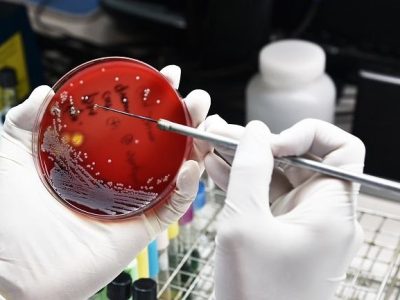 Ancaman Superbug Meningkat: WHO Sebut Infeksi Bakteri