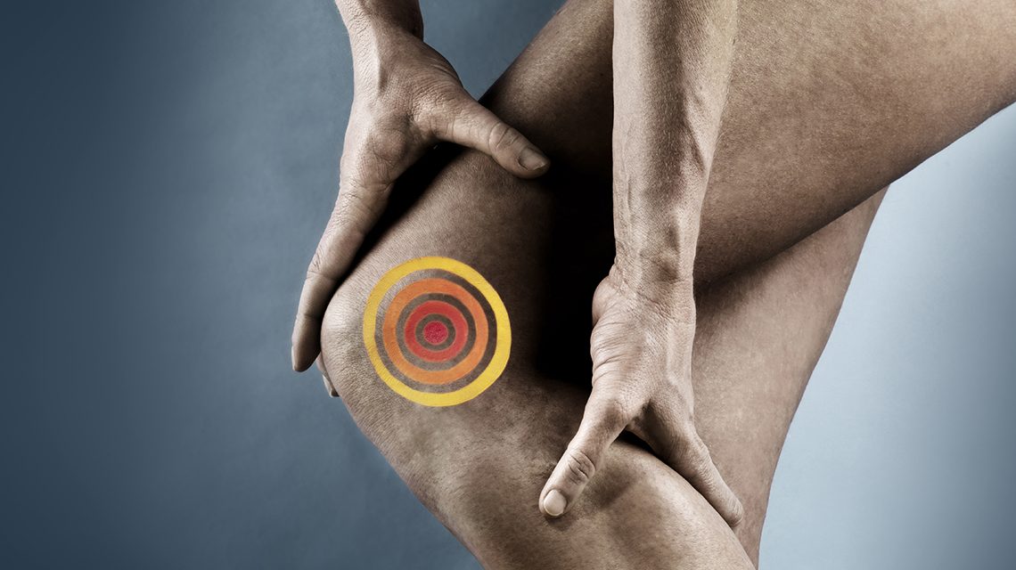 Lutut Nyeri Saat Cuaca Dingin, Ini 3 Faktor Penyebabnya